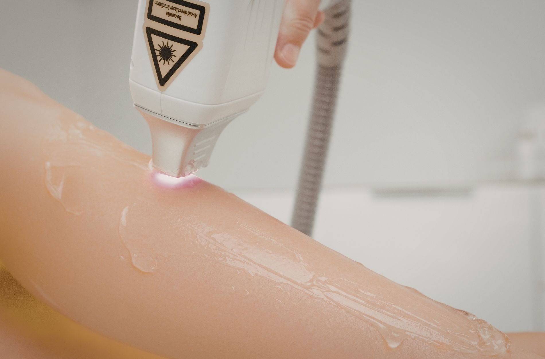 Questioning Hair Removal? When Laser Becomes the Better Choice