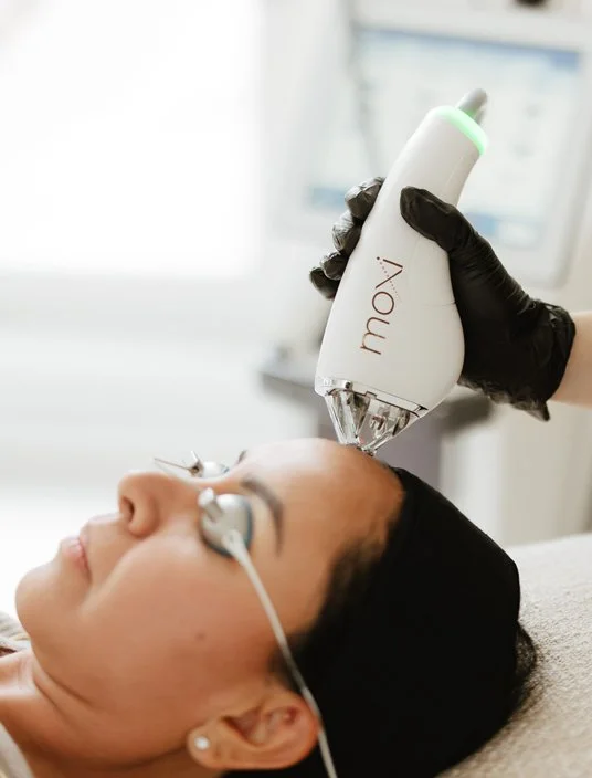 Provider positions the Sciton MOXI fractional laser handpiece over a client’s forehead at Reviv Lounge in Oconomowoc, Wisconsin.