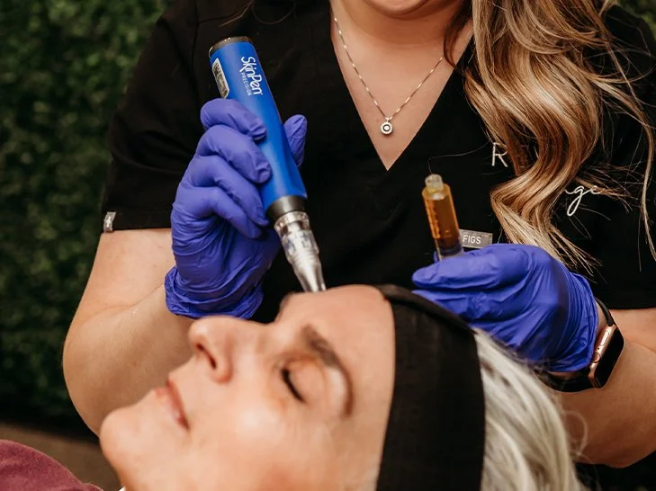 SkinPen Microneedling n Oconomowoc Wisconsin
