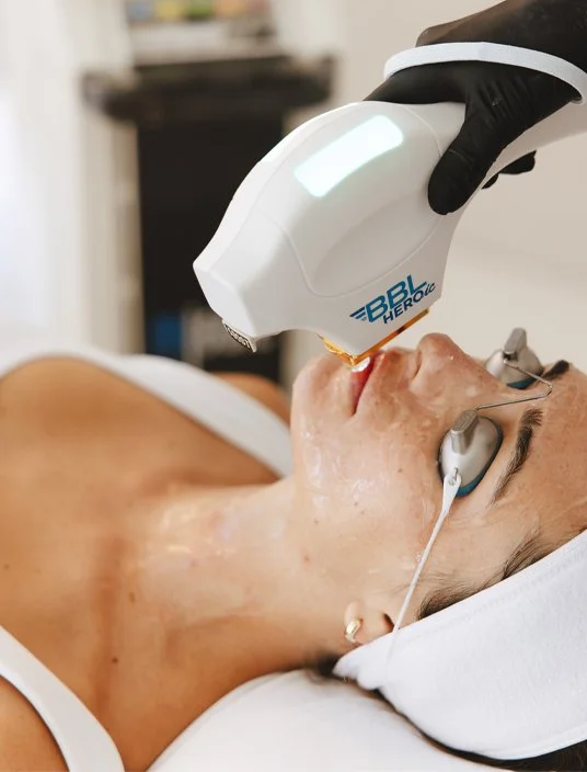 Client wearing protective eyewear while receiving a Sciton BBL HEROic facial treatment at Reviv Lounge in Oconomowoc, Wisconsin.