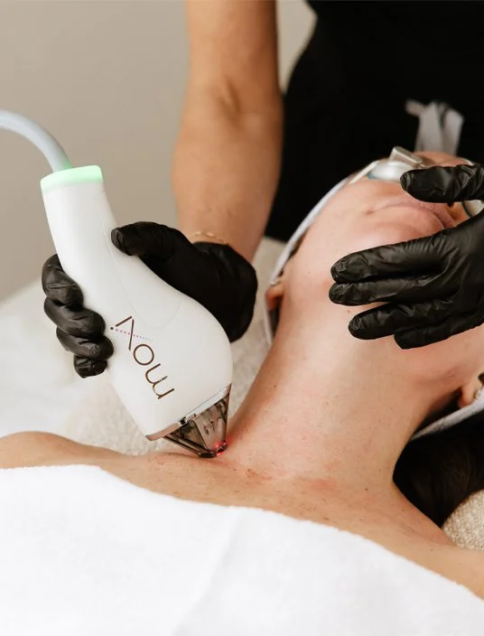 Client wearing protective eyewear receives a Sciton MOXI laser treatment on the neck and upper chest at Reviv Lounge in Oconomowoc, Wisconsin