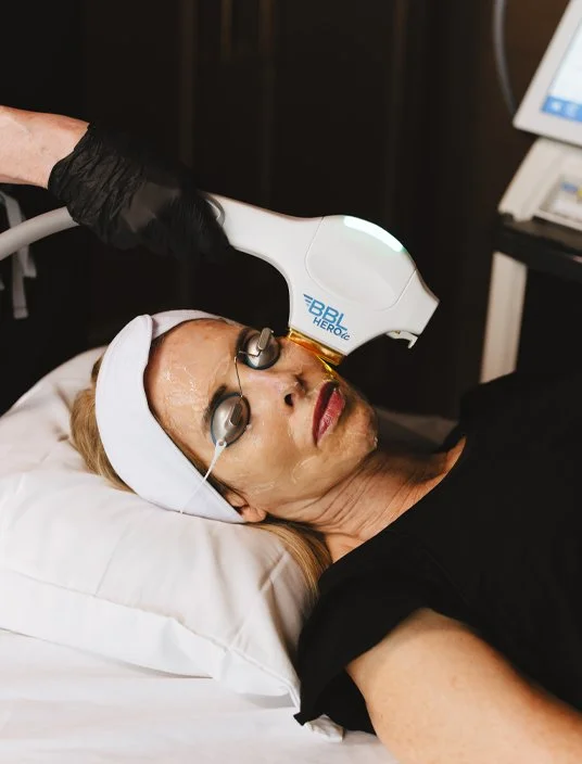 A client receiving a customized Sciton BBL HEROic treatment on her face at Reviv Lounge in Oconomowoc, serving Wisconsin’s Lake Country communities.