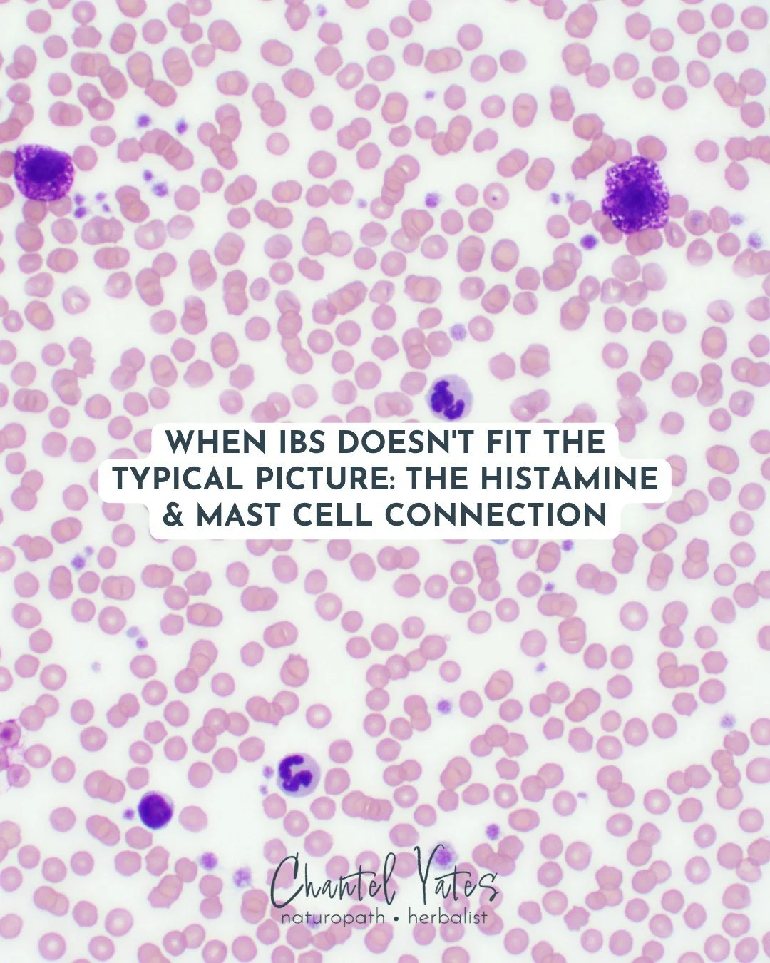 Many people with IBS also experience food sensitivities, rashes, brain fog, or cyclical flares that don't quite fit the standard picture.

For these individuals, mast cell activation and histamine intolerance may be part of the story.

Recent researc