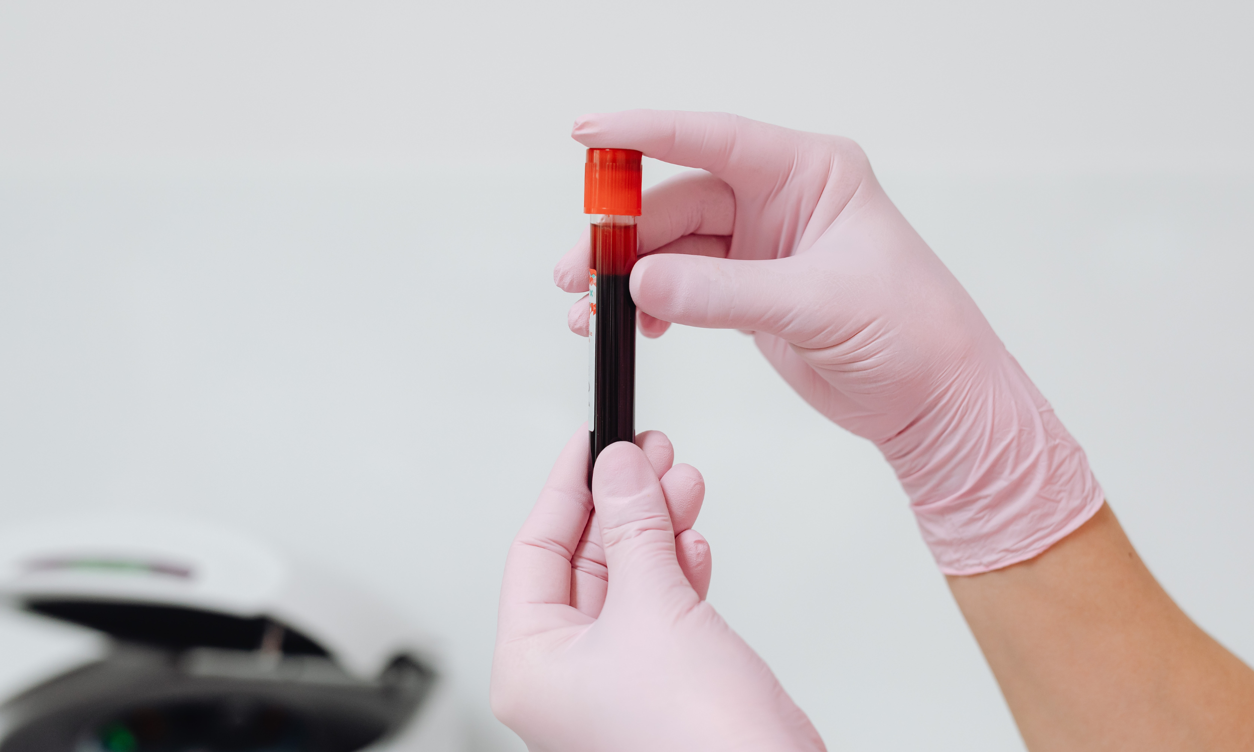 Iron Deficiency &amp; Gut Health: What Most People (and Practitioners) Miss