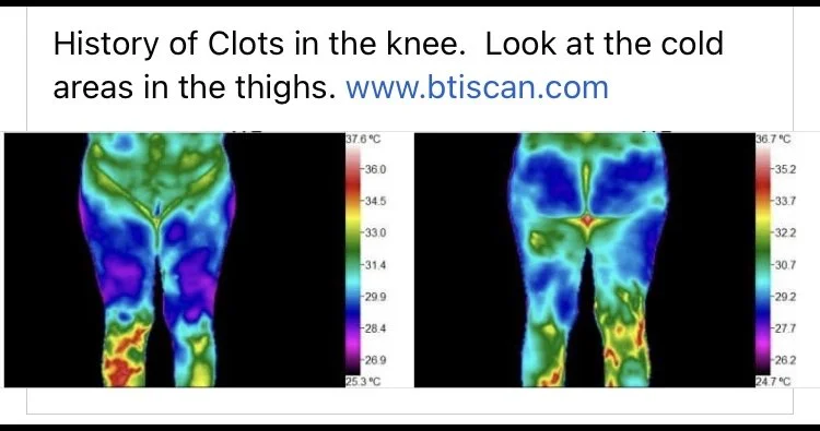 thermography dunks