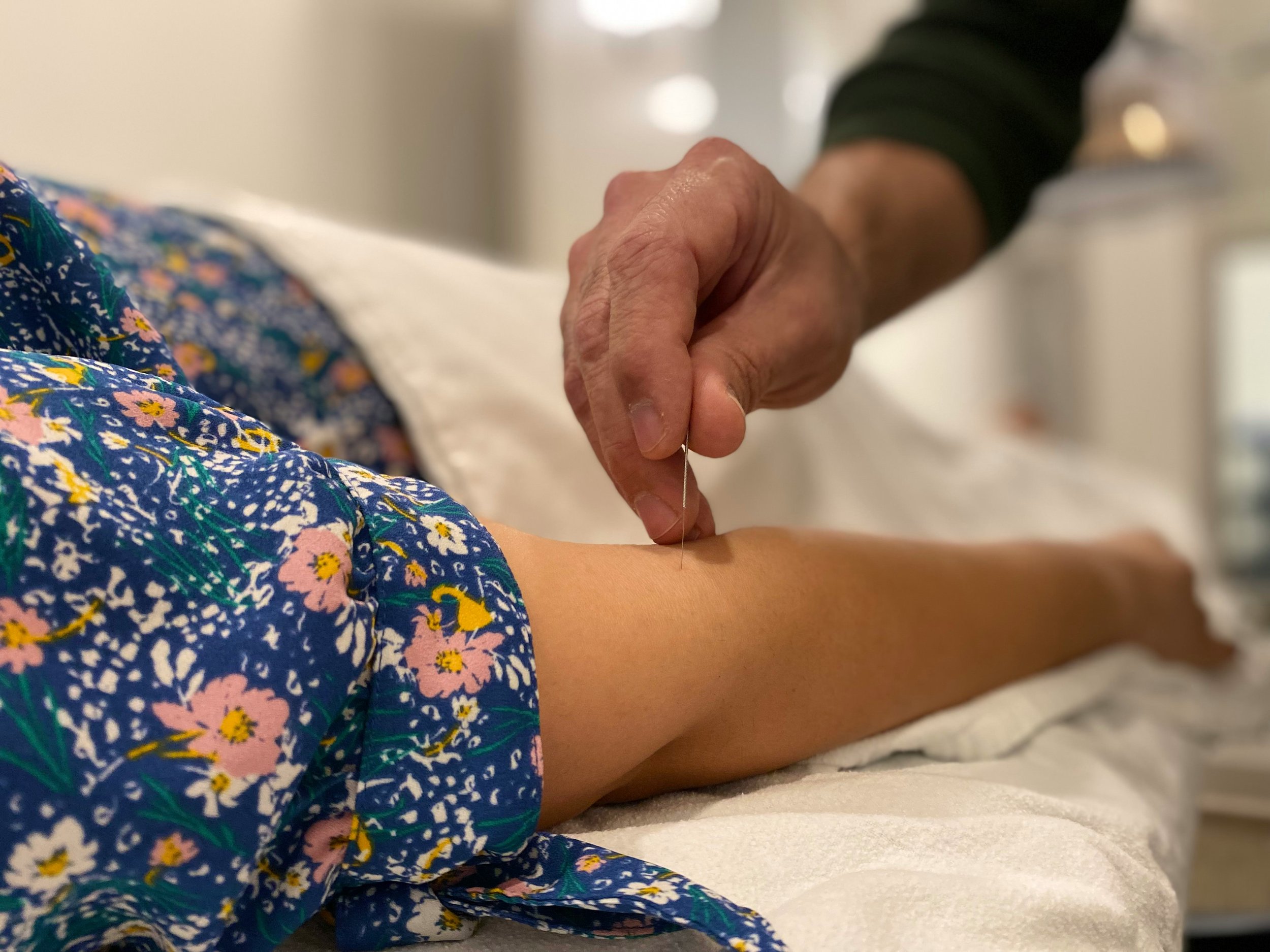 Acupuncture in the United States