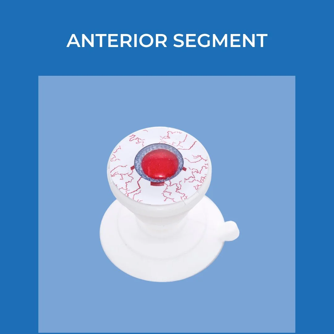 Model of the anterior segment of the eye showing the cornea, iris, and pupil.