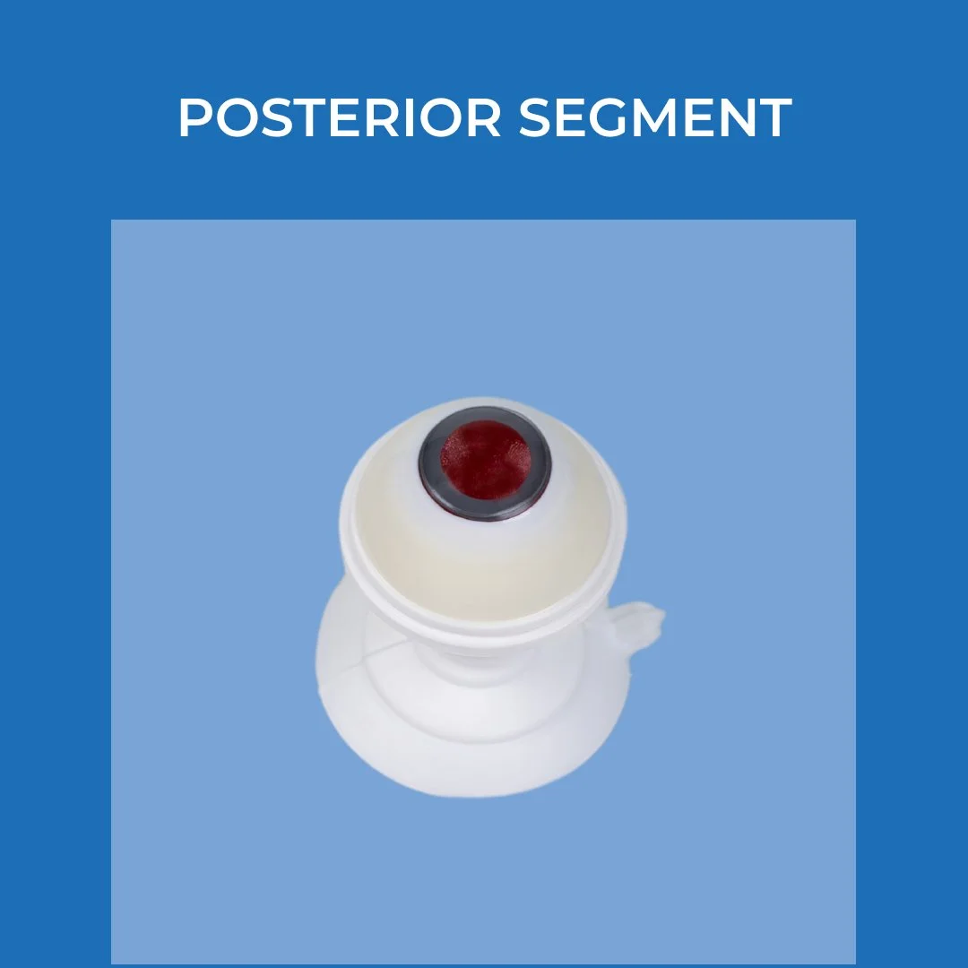 Medical illustration of a posterior segment eye model showing the retina and optic disc.