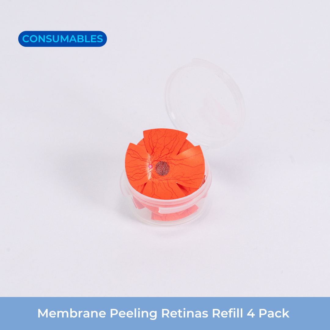 Membrane Peeling.png