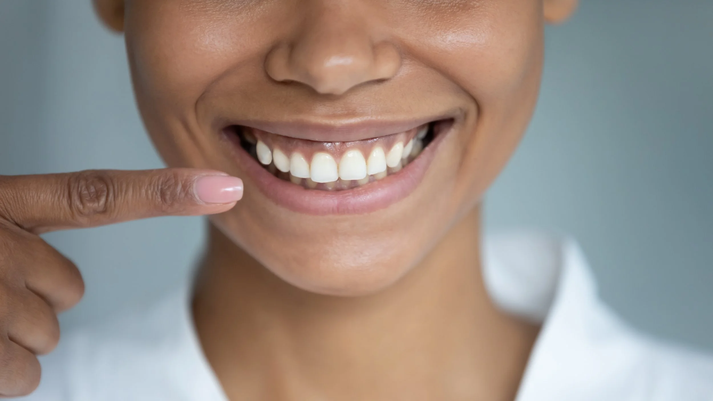 Teeth Whitening