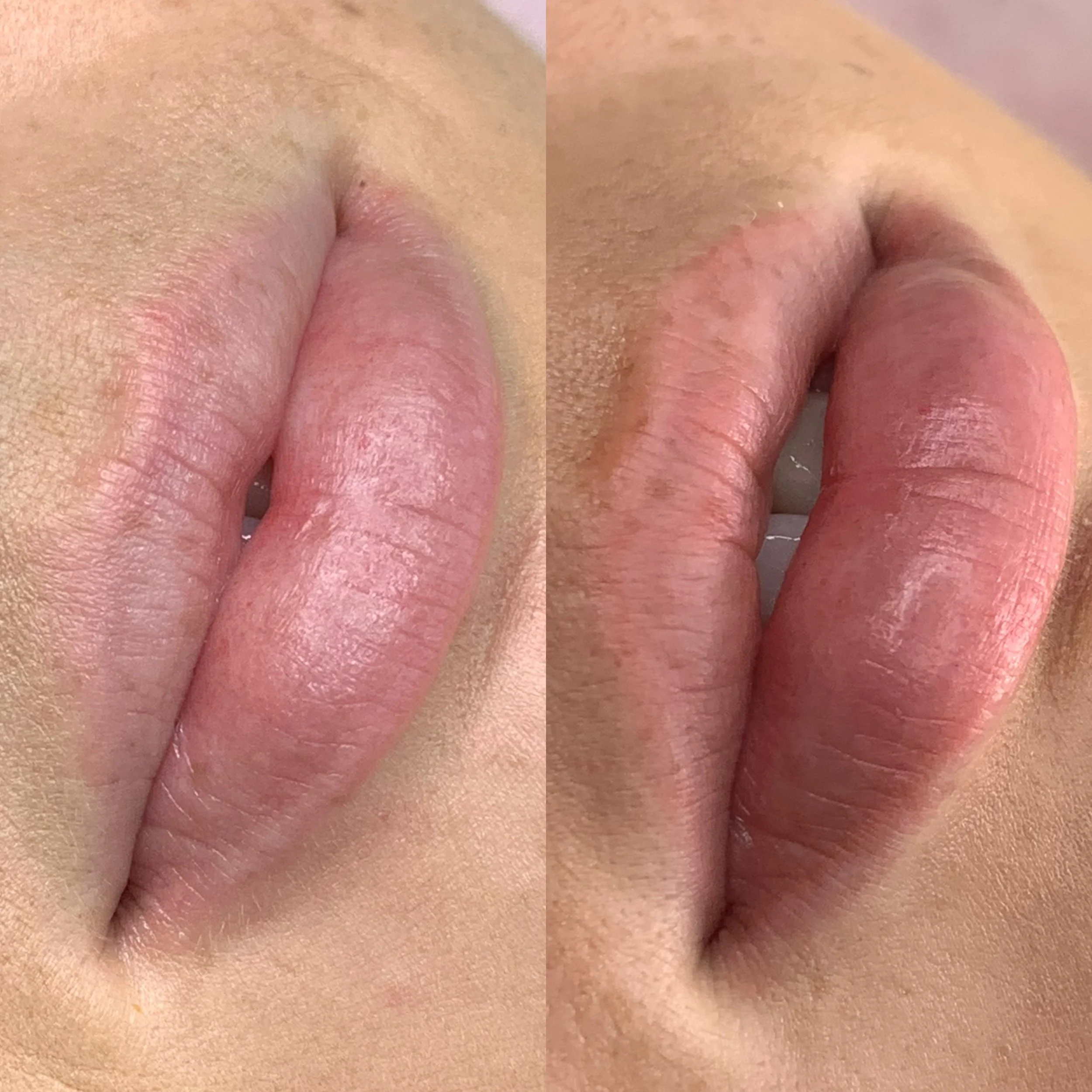 Soft healed lips.JPG