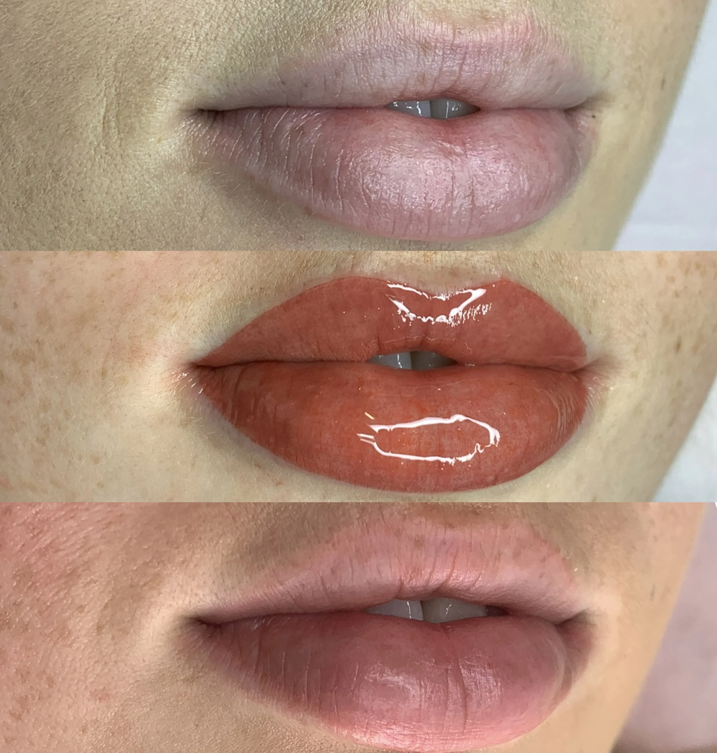 Process of lip tattooing.jpg