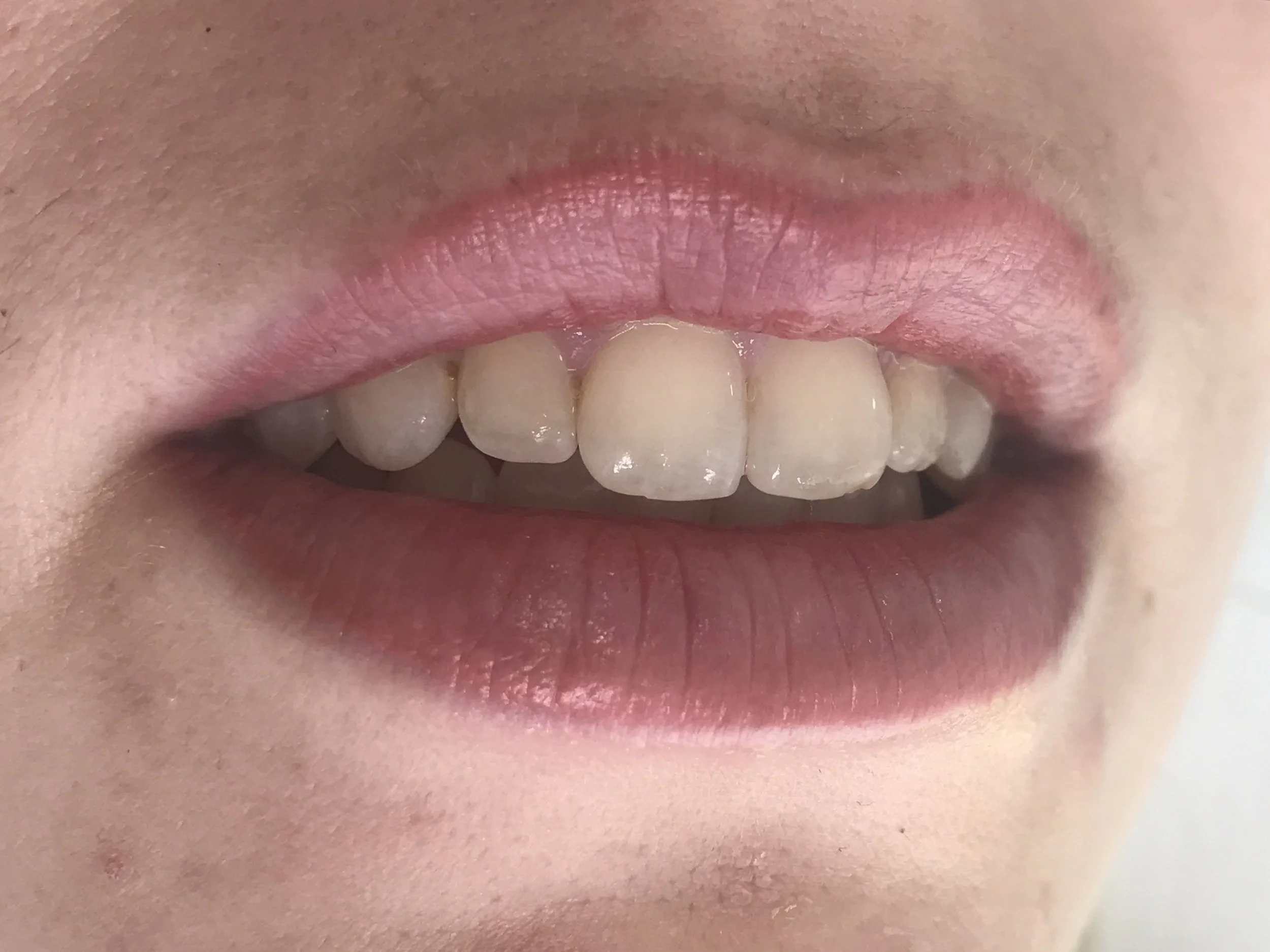Healed lip blend.jpg