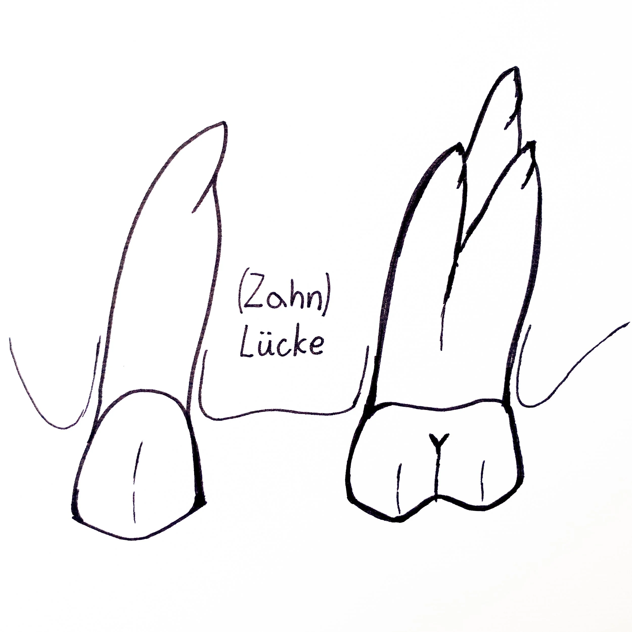 Zahnarzt Linz_Zahnlücke.jpg