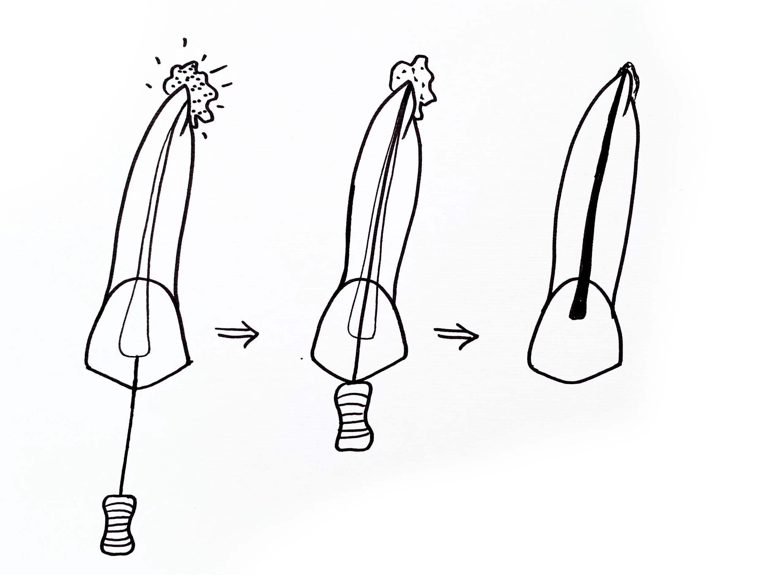 Zahnarzt Linz_Wurzelbehandlung.jpg