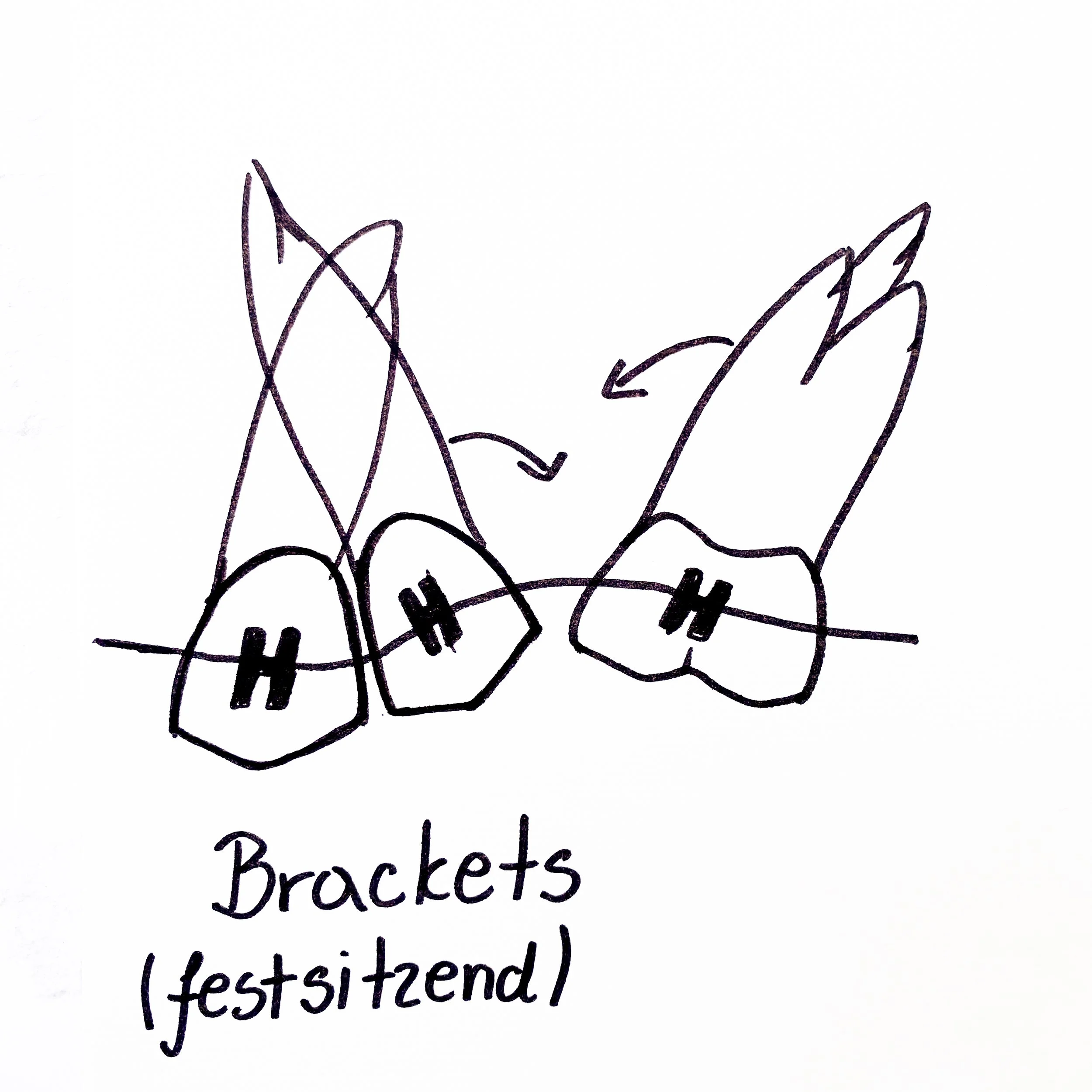 Zahnarzt Linz_Brackets.jpg