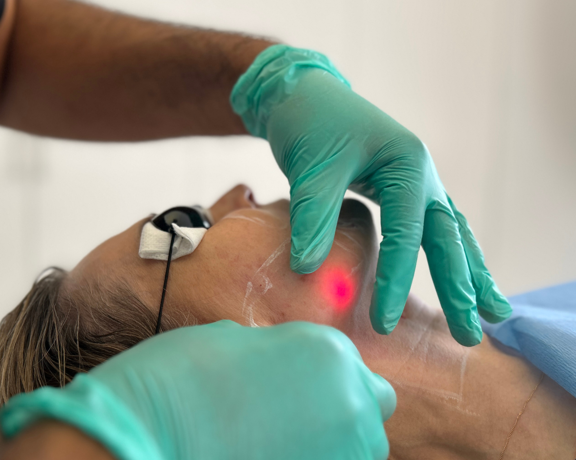 Endolift and CO2 Laser: Why Combining Deep Tightening with Surface Resurfacing Gives the Most Complete Result