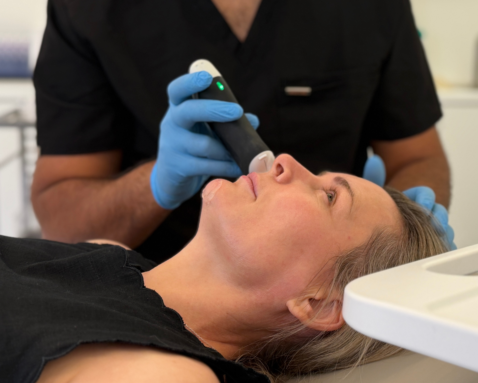 Topilase: Dissolving Filler Without Injections