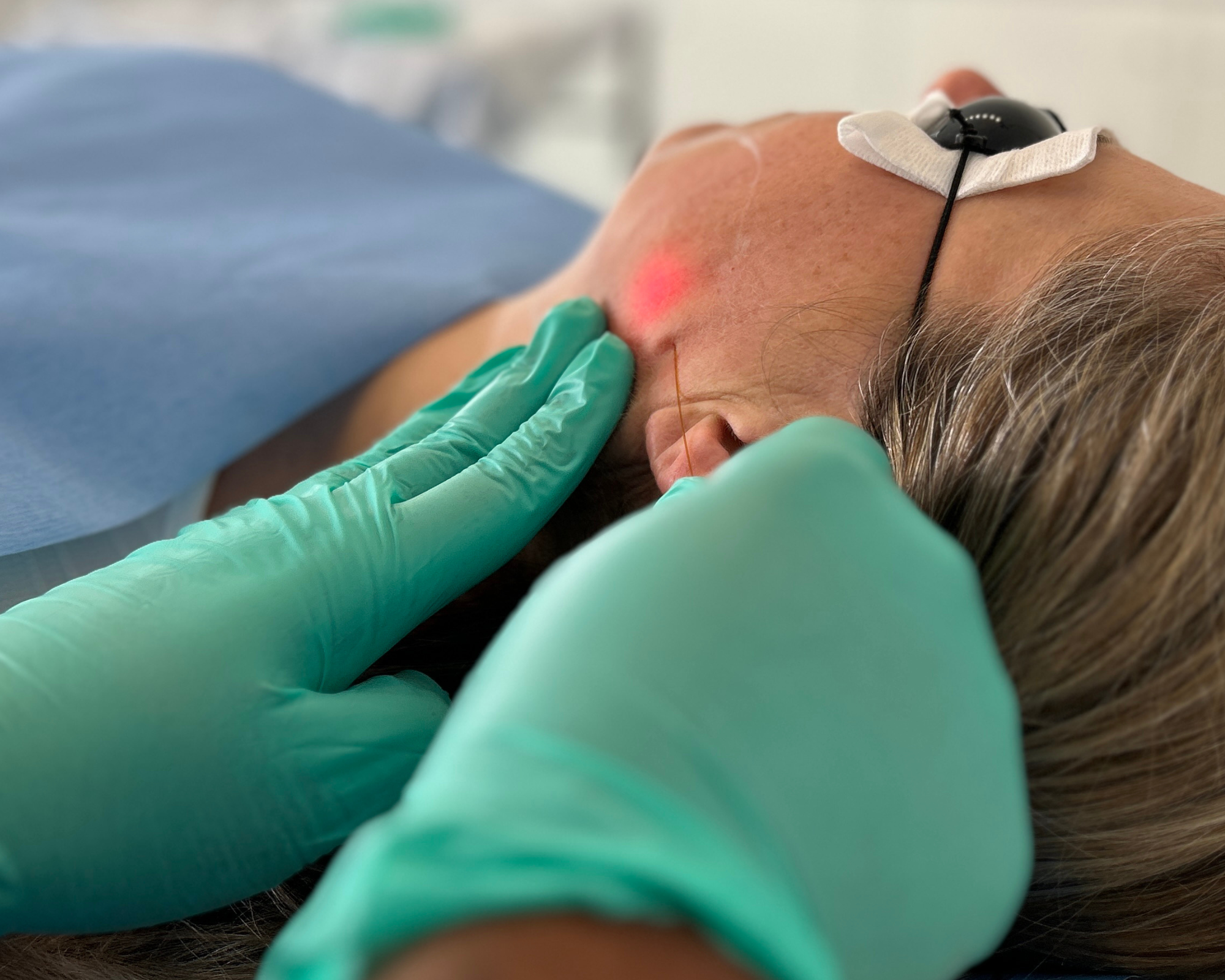 Endolift skin tightening laser treatment at Karwal Aesthetics, doctor-led clinic in Mayfair, London.