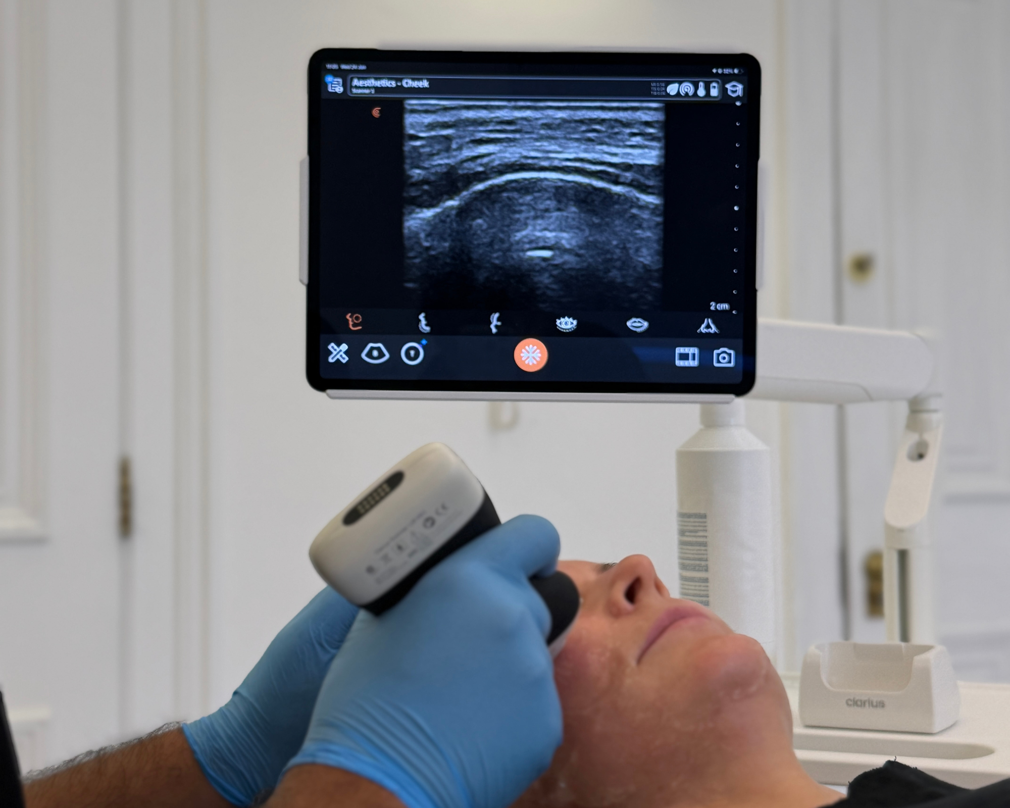 ultrasound-guided-examinations-fillers-dissolving
