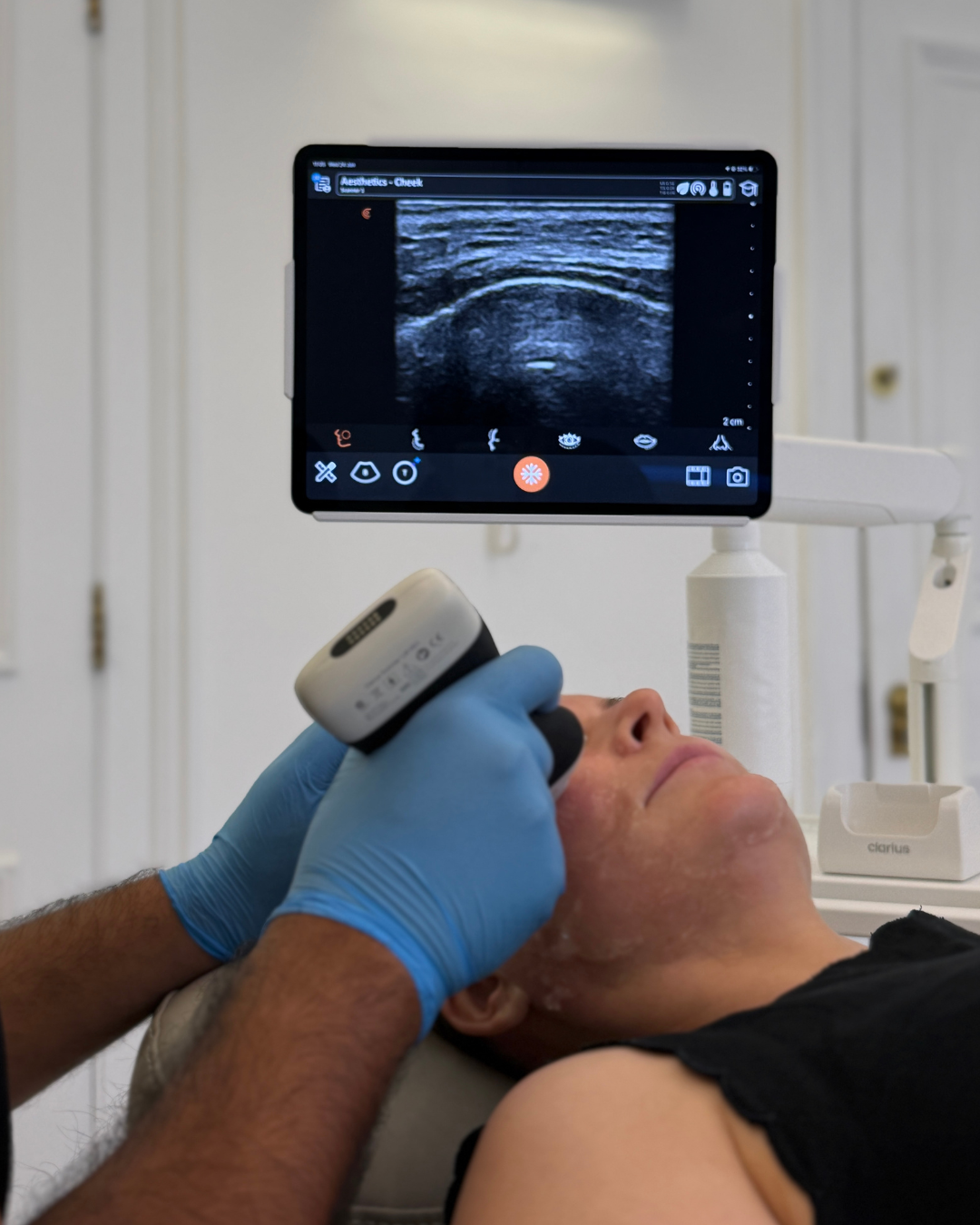 Dr Karwal performing an ultrasound scan before filler dissolving at Karwal Aesthetics, with tissue visible on the monitor.