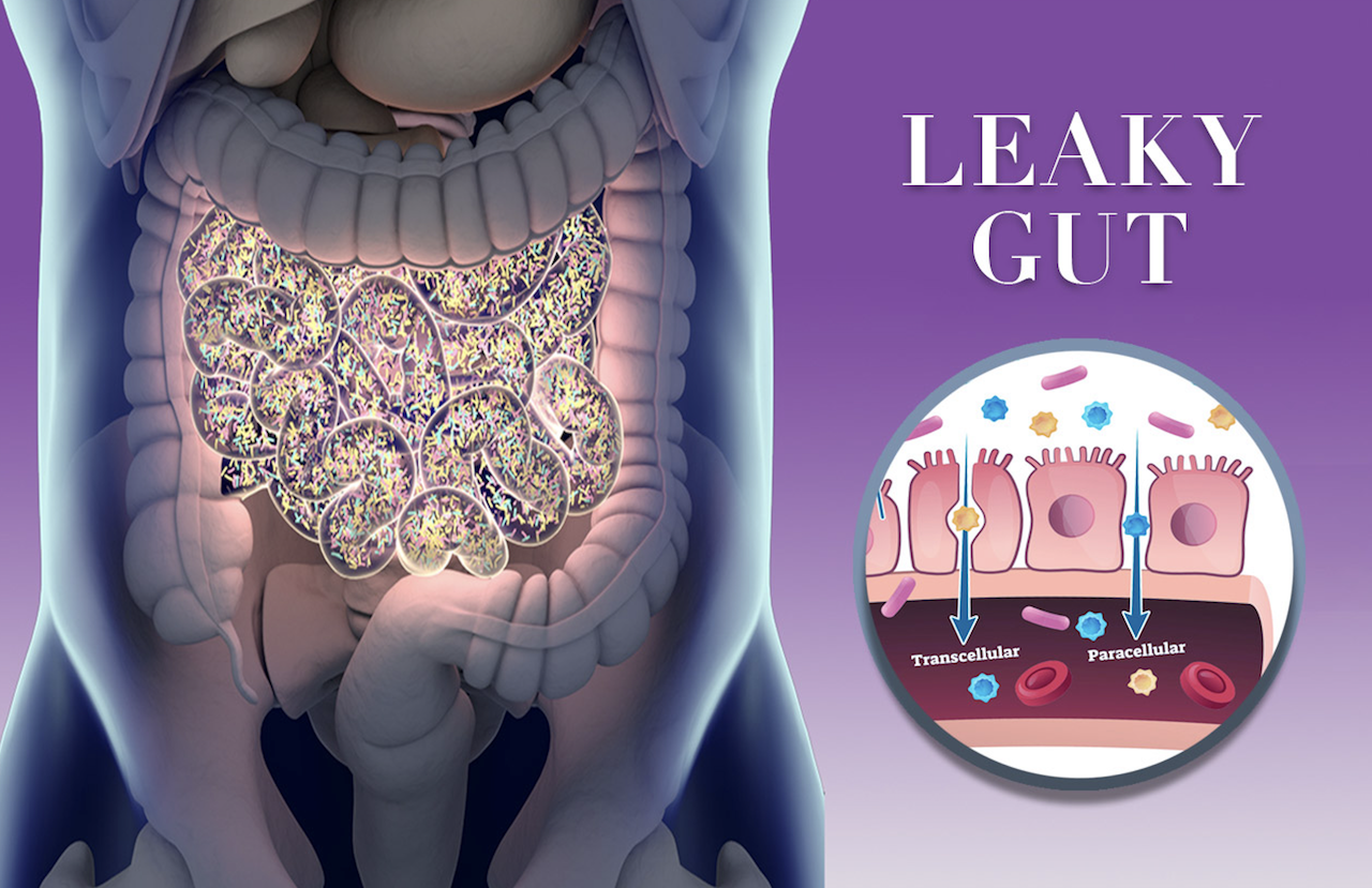 Leaky Gut Diet: The Best Anti-Inflammatory Foods To Eat For Gut Health, According To Dietitians