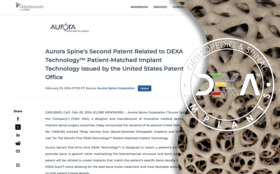 News article about Aurora Spine's second patent for DEXA technology, with background image of bone structure.