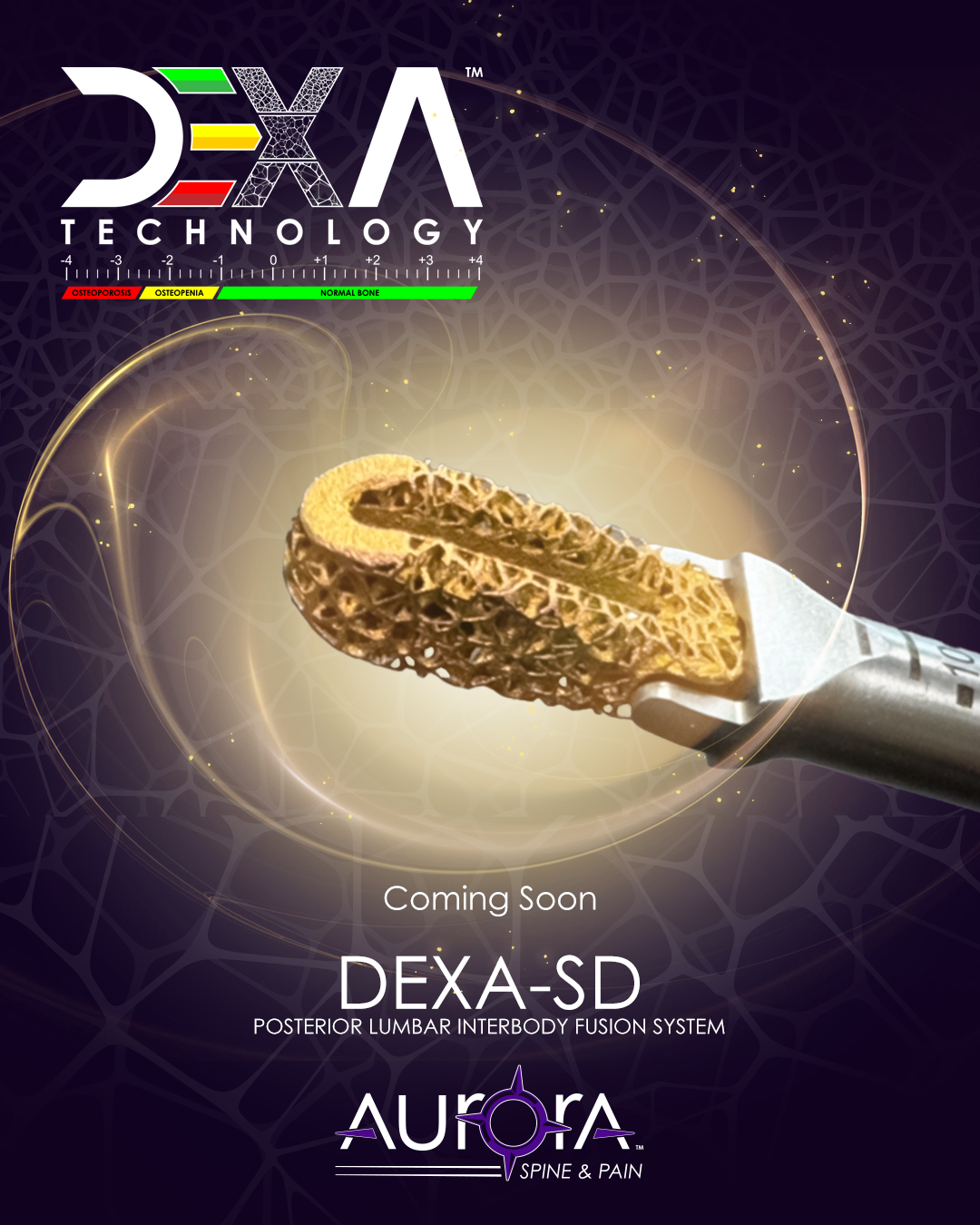 A promotional poster for DEXA-SD, a posterior lumbar interbody fusion system by Aurora Spine & Pain, featuring a gold-colored interbody spacer implant with glowing light effects in the background, and a colored gauge indicating bone density levels.