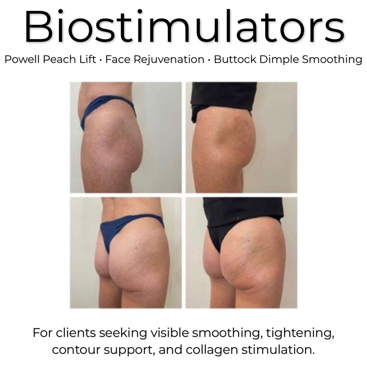 Hot Girl Summer - Sculpt + Visible Lift + Contour