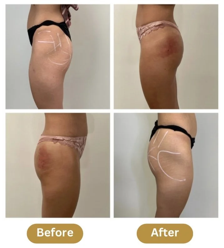 Before and After | Powell Studio Hanover MA