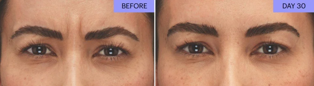 B+A Botox3.jpg