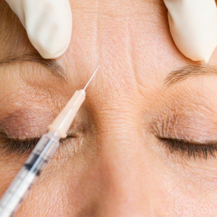 Ready to say goodbye to those pesky wrinkles? 💉 Botox injections may be just what you need! 💁&zwj;♀️

Our expert injectors can help smooth out fine lines and wrinkles to give you a refreshed and youthful look. Plus, the procedure is quick and effic