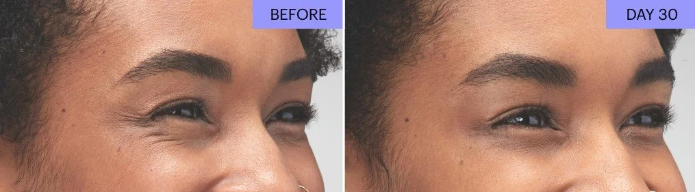B+A Botox 5.jpg