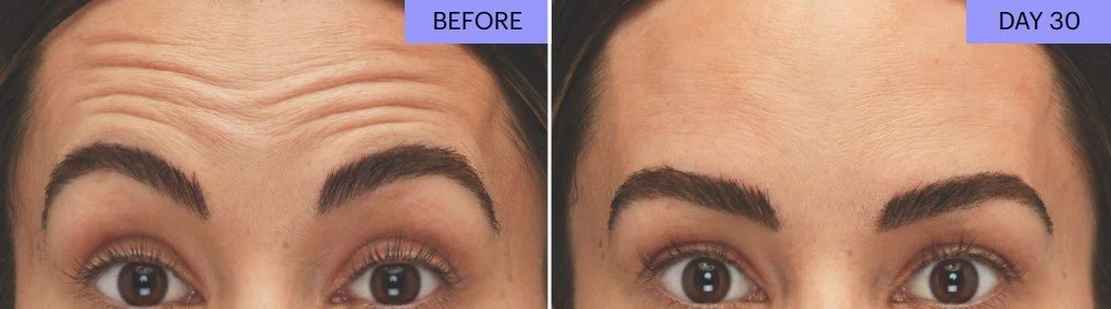 B+A Botox.jpg