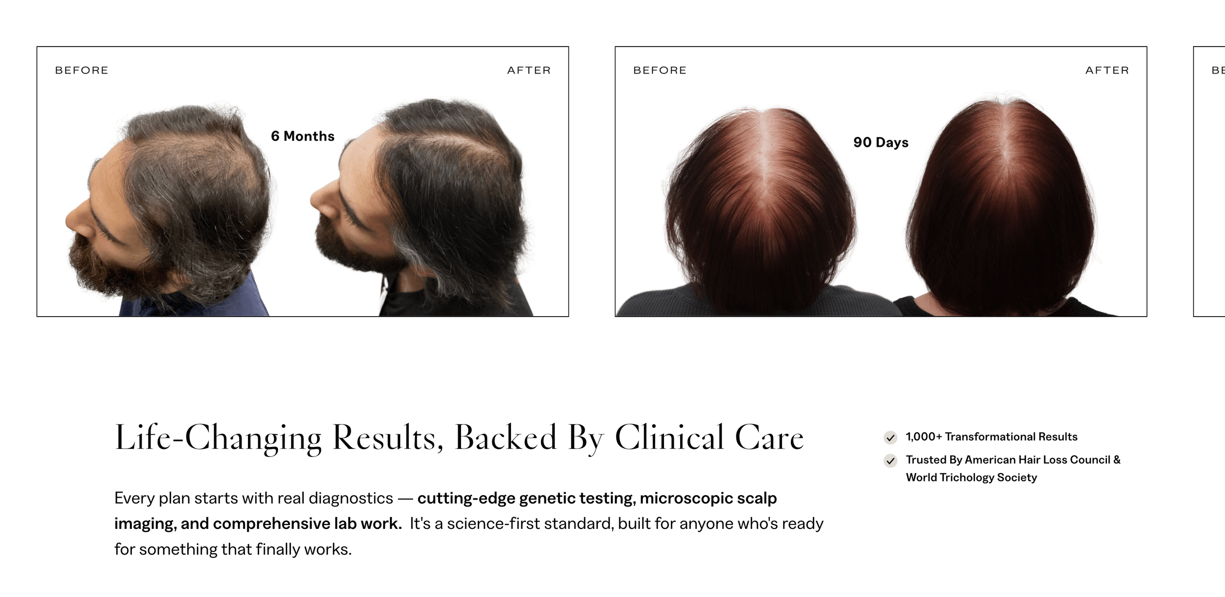 before and after photos for med spa website