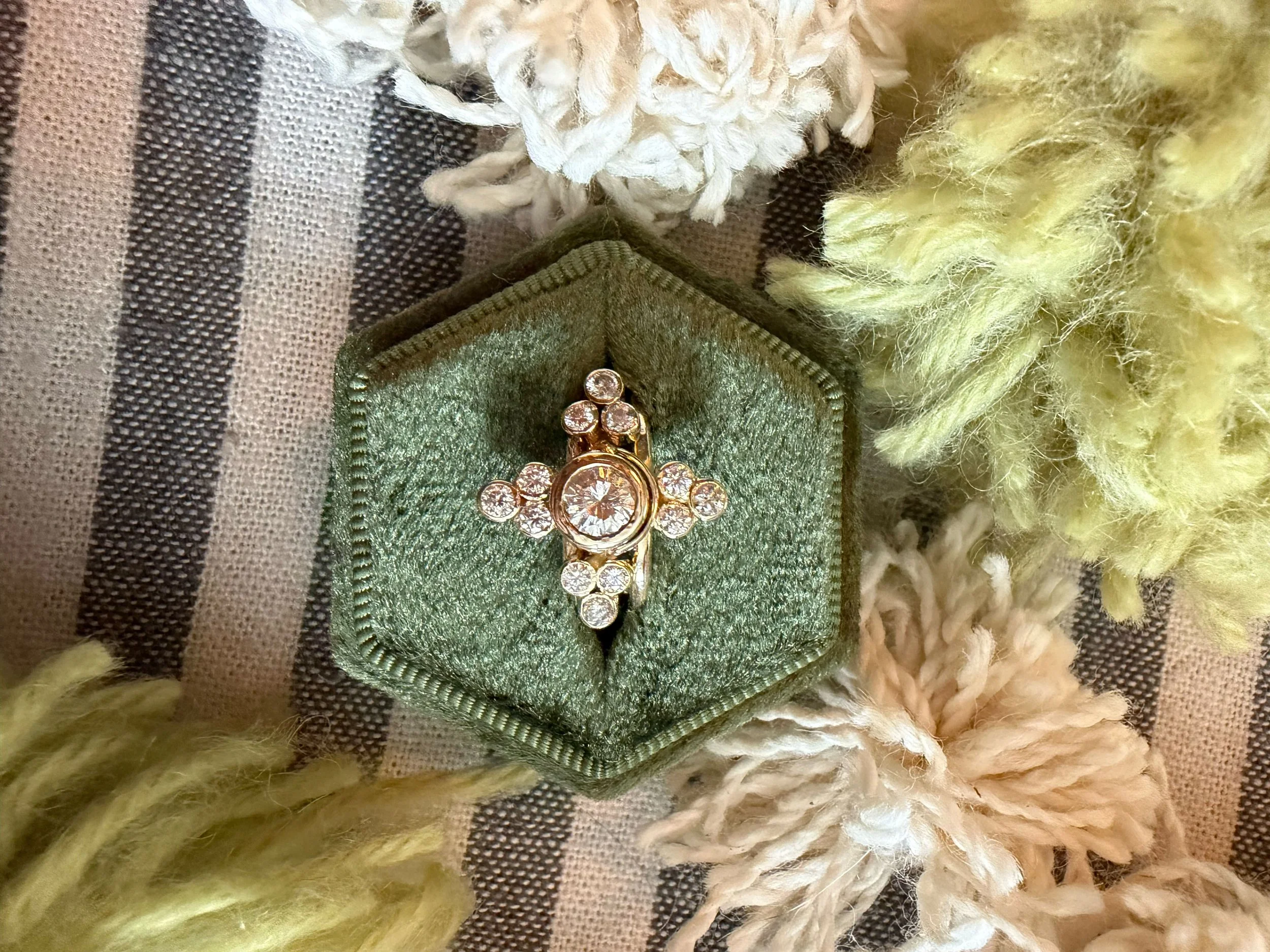 What I Did When My Wedding Ring No Longer Fit After Weight Loss