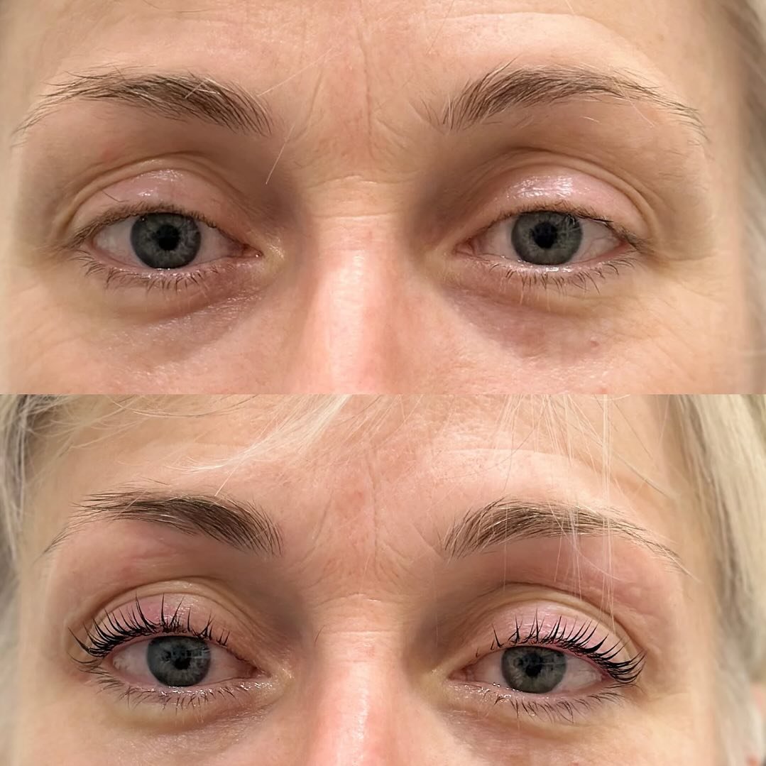 🌟Are you tired of constantly applying mascara to enhance your lashes? 

We&rsquo;ve got you sorted! 

With Ursk Medispa's Lash Lift and Tint service, you can achieve long-lasting results without the hassle of daily makeup application. 

Lash lifts l