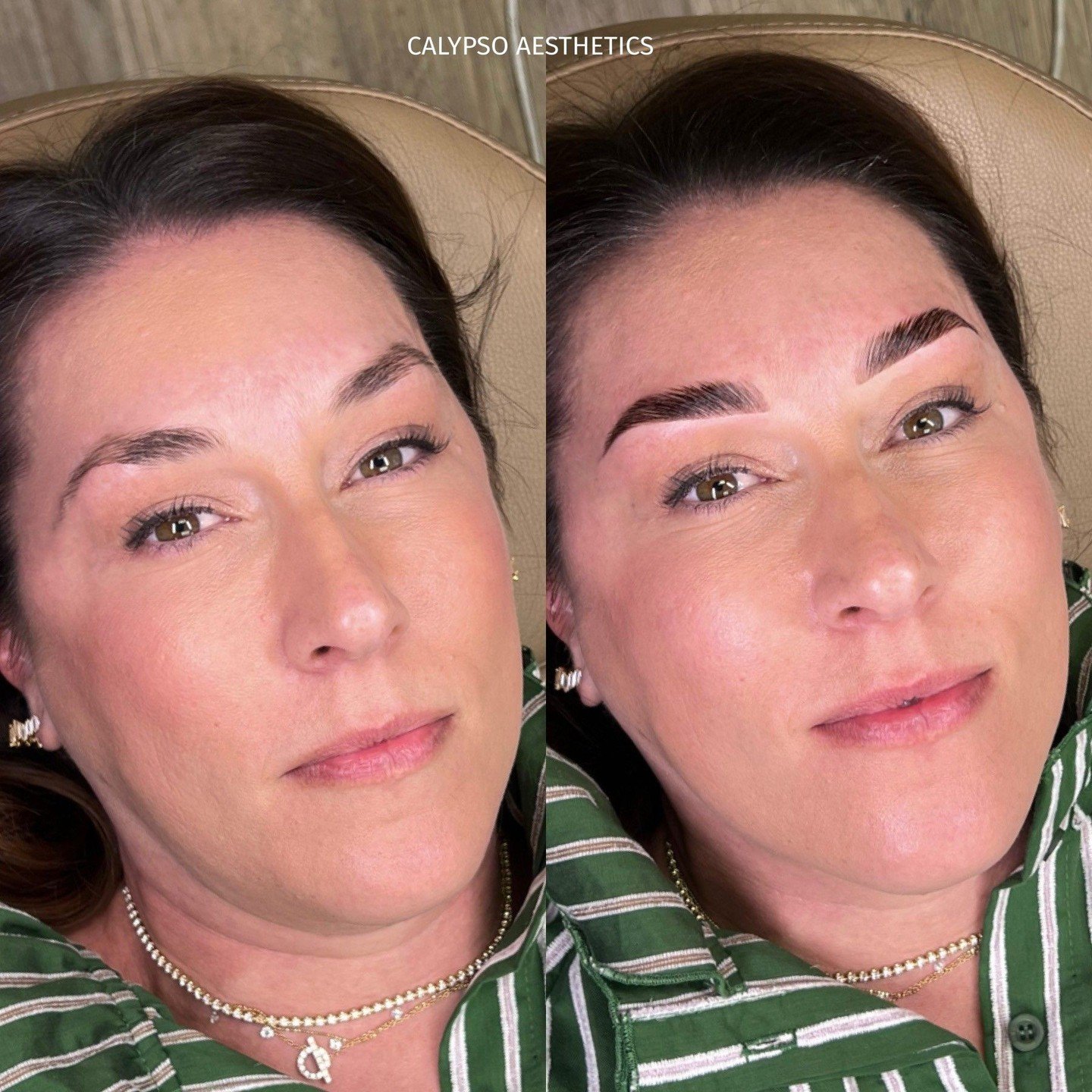 Effortlessly full brows are one of our favorite treatments at Calypso! ⁠
⁠
This beautiful patient received a brow tint and lamination for a more defined brow shape from @browsbylomuns! One of our favorite benefits of this treatment is it's low mainte