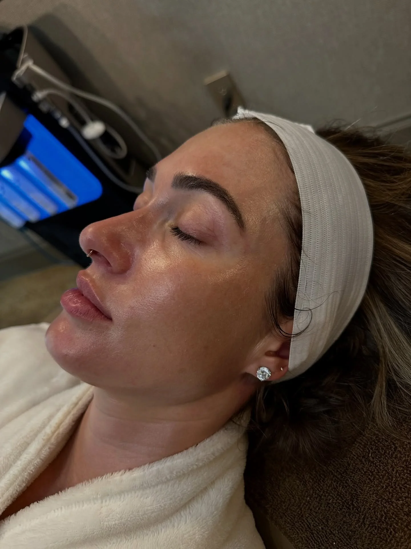 That post-HydraFacial glow hits different. ✨

Whether you&rsquo;re prepping for an event or just want that fresh-faced confidence, #hydrafacial has you covered. 

Want clean pores, hydrated skin, and instant radiance? Book yours now. 

#skincare #acn