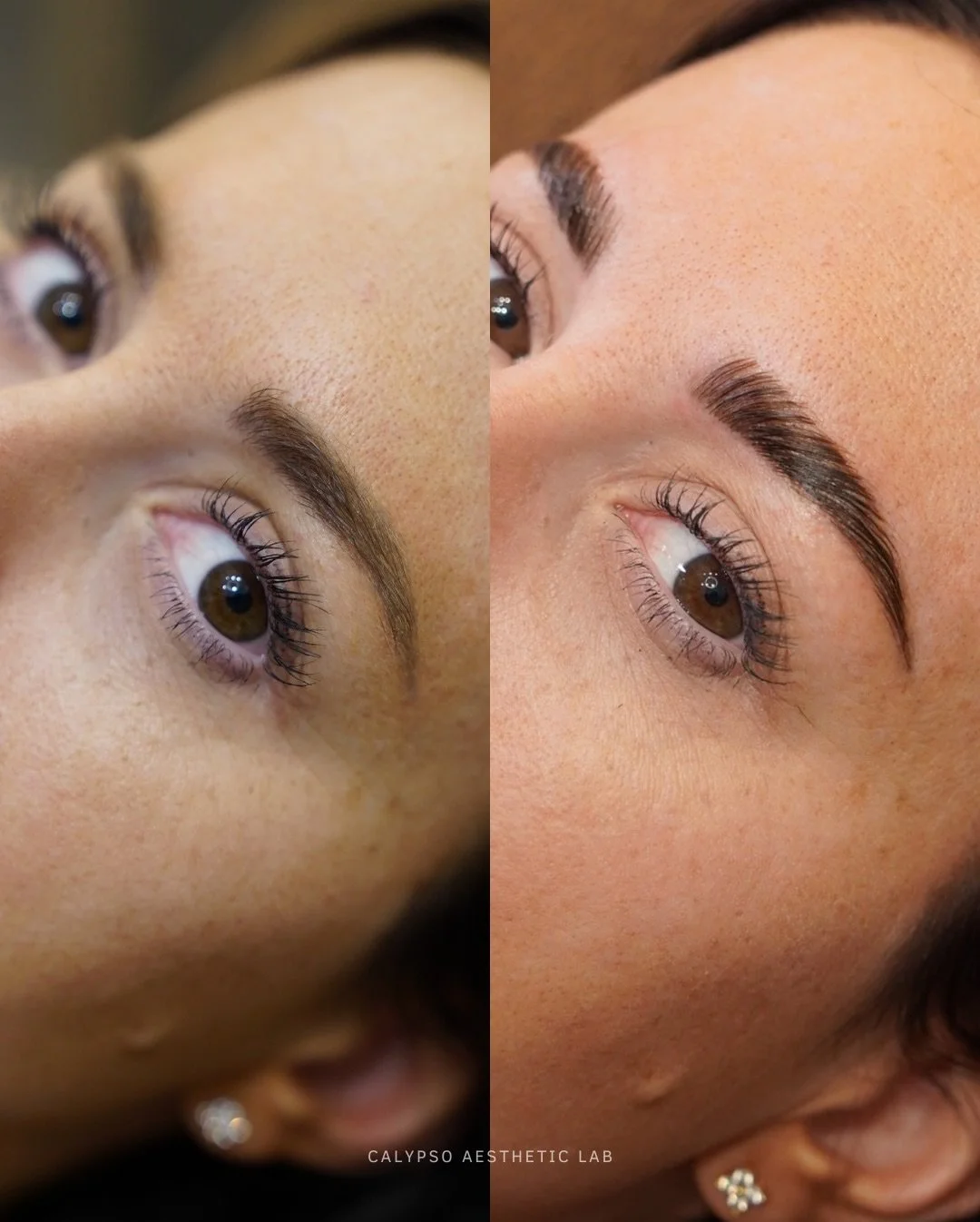 Brow lamination 101 ✨

More than creating a &ldquo;fluffy brow&rdquo;, the brow lamination process is designed to reshape, set, and enhance your natural brow pattern.

How does it work? The treatment relaxes the brow hairs so they can be redirected i