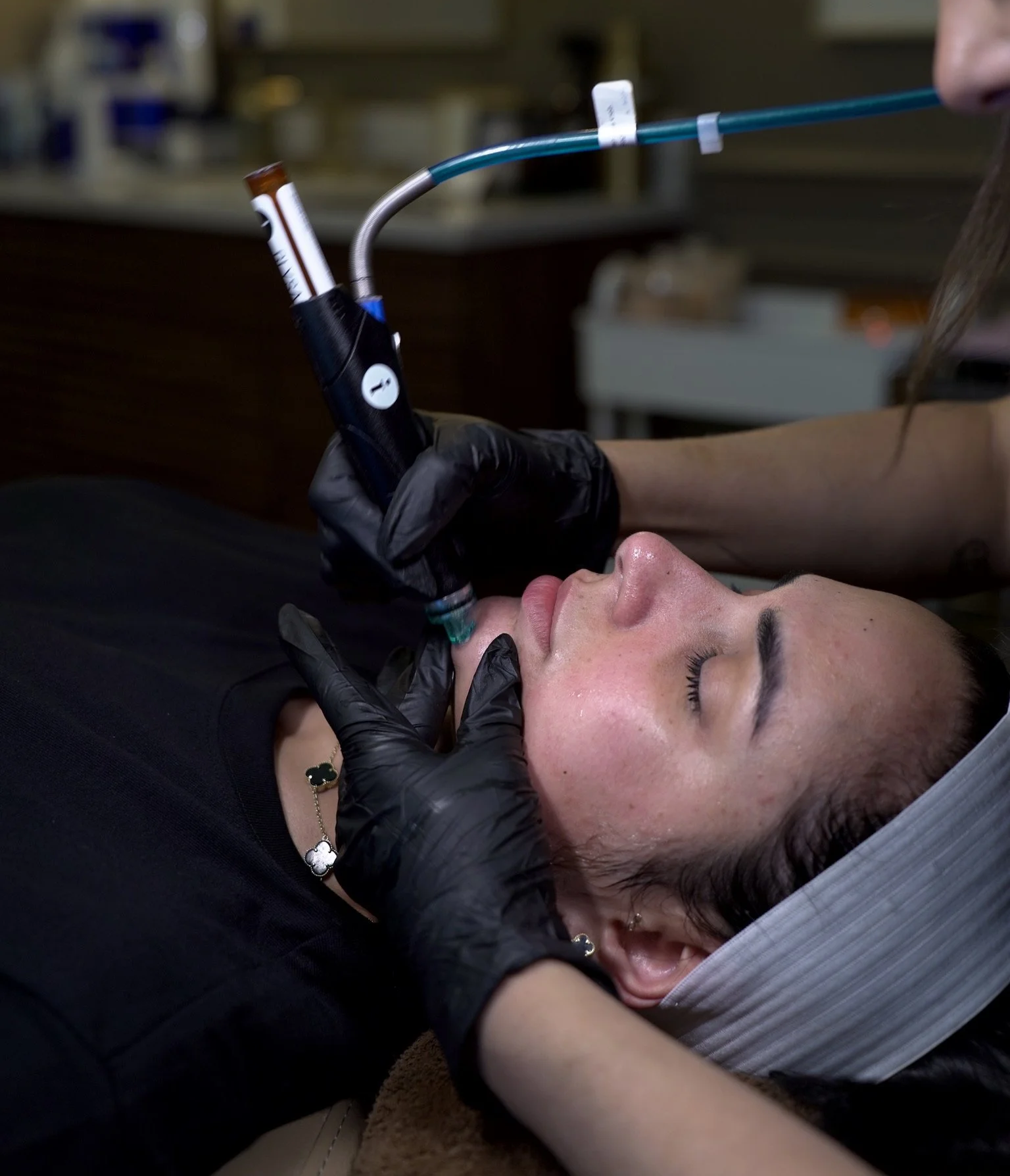 A woman lying down with her eyes closed, receiving a cosmetic procedure with a device held by a technician wearing black gloves.
