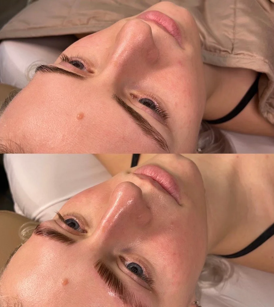 Close-up of a woman lying down, showing her face with eyelash extensions, slightly shiny skin, and a mole on her forehead.