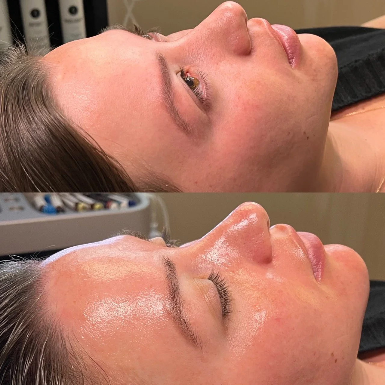 Side-by-side comparison of a woman's face before and after a skincare treatment, with shiny, smooth skin post-treatment.