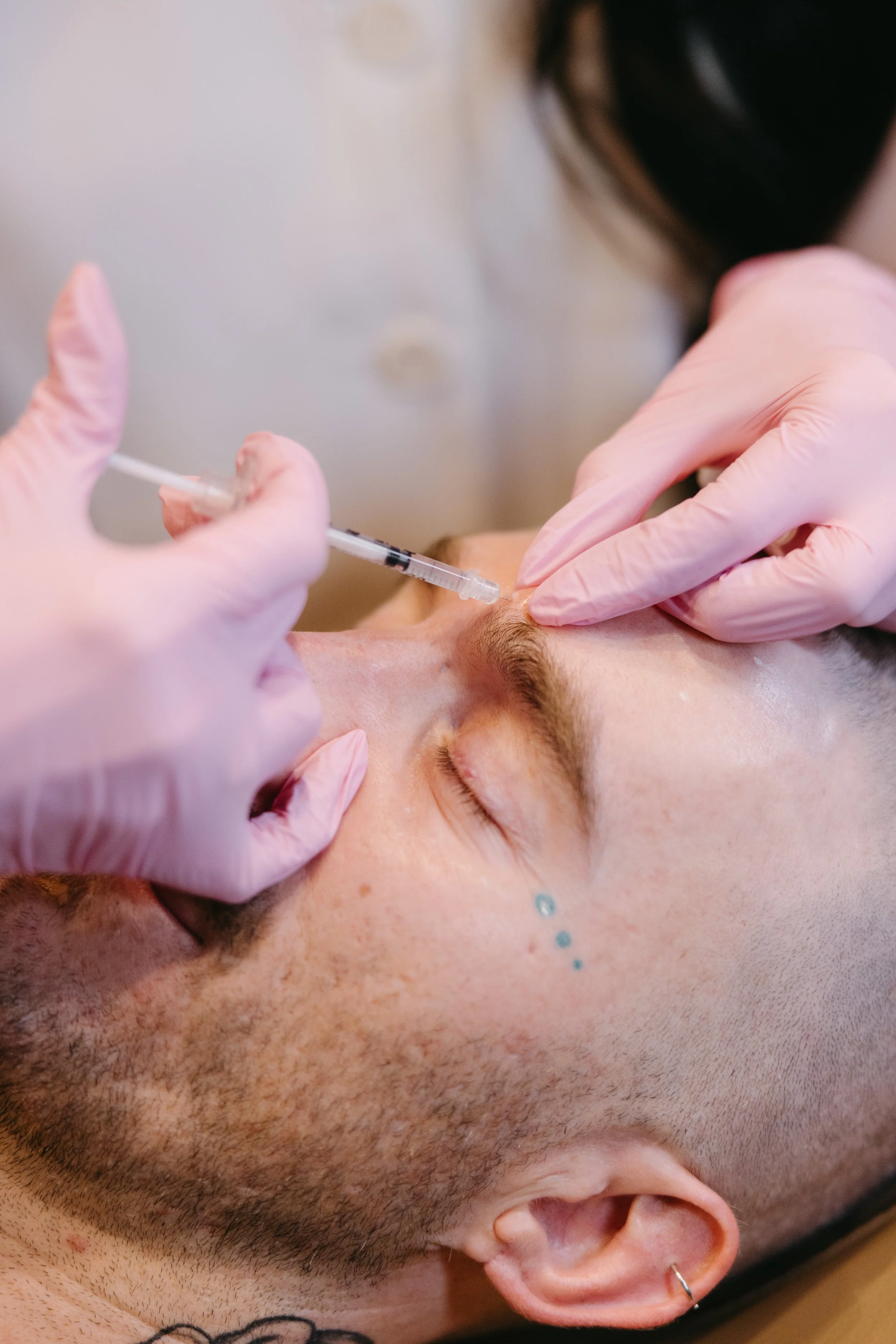 Person receiving a cosmetic injection in their forehead from a medical professional wearing pink gloves.