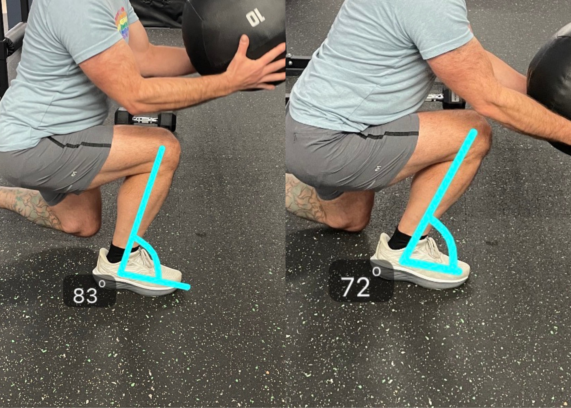 a male patient completing a medicine ball split stance drop before and after cueing for an improved shin angle as part of his physical therapy after ACL reconstruction