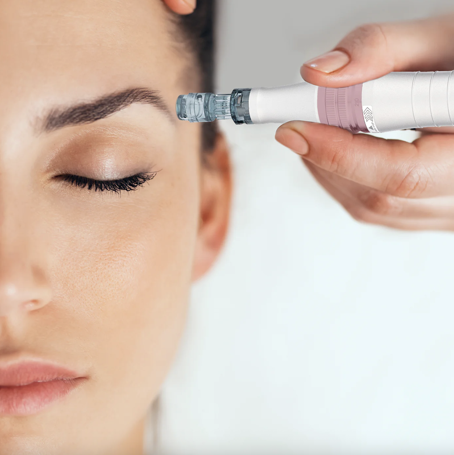 What is Nano-Needling?