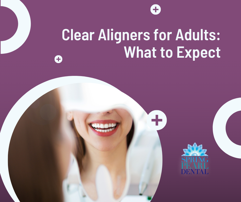Clear Aligners for Adults: What to Expect