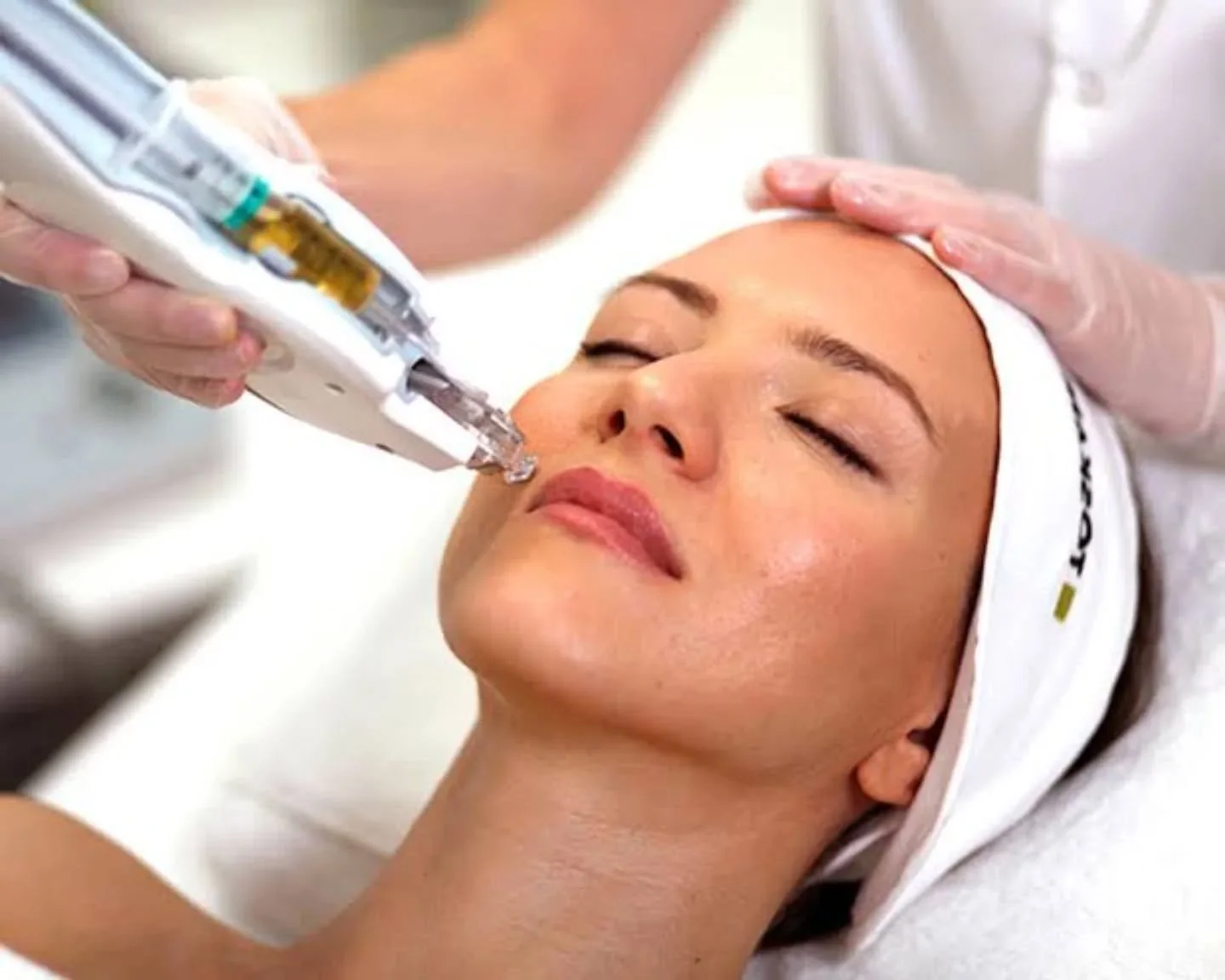 Visste du at v&aring;r kosmetiske sykepleier utf&oslash;rer mesoterapi?
En oppstrammende behandling som tilf&oslash;rer vitaminer og fukt🙂 reversere aldring av huden.

Du kan booke time hos henne her
https://www.karolineshudpleie.no/
#mesotheraphy #