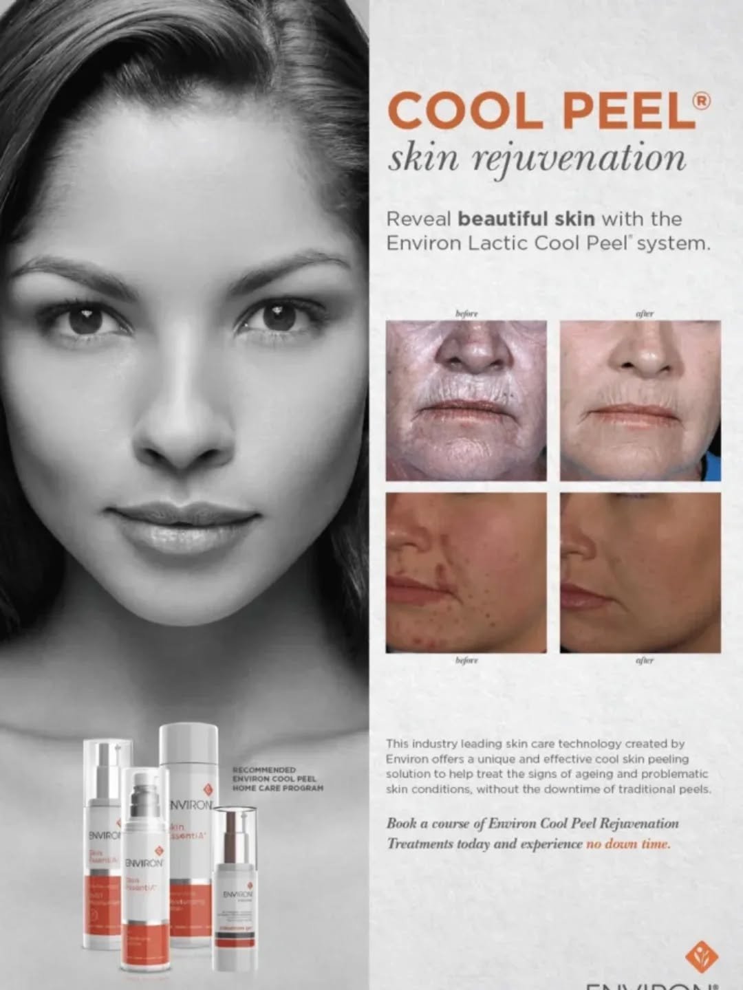 Environ cool peel er en fantastisk peel🤩
Anti age, hudforbedrende ved problemer i huden, som acne, solskader og fukttap.

N&aring; f&aring;r du coolpeel express til 650kr, til og med uke 7. 

Book tid her
https://www.karolineshudpleie.no/

Eller kon