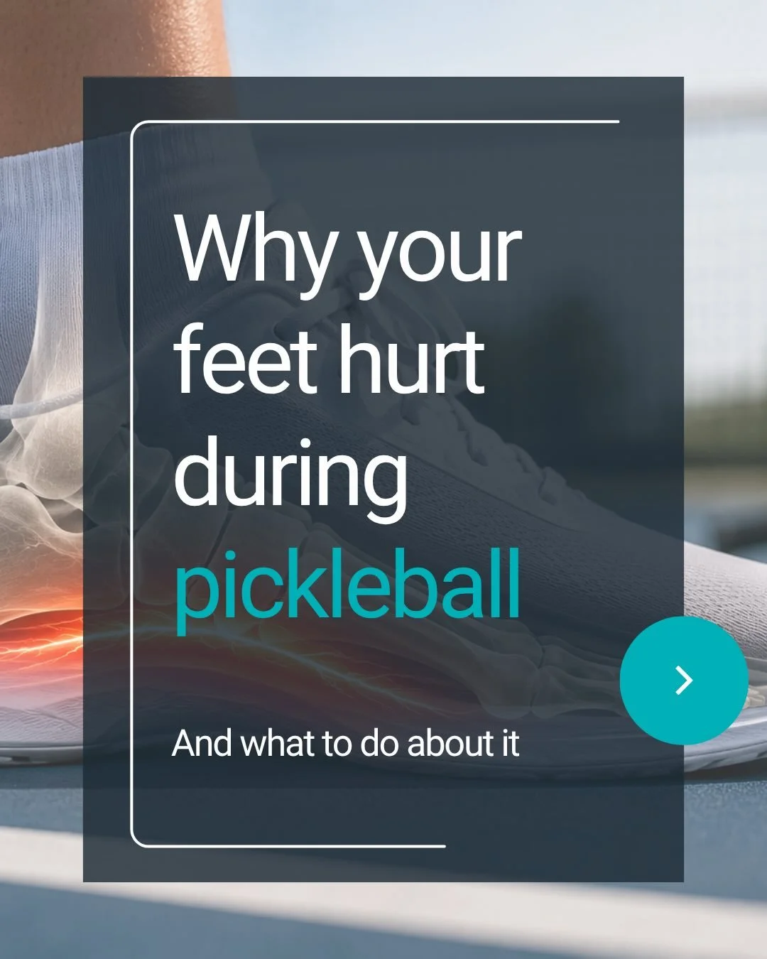 Foot pain during pickleball is one of the MOST common things I see 👣🎾

A lot of people assume they just need better shoes, more stretching, or to stop playing altogether.

But usually the bigger issue is that the foot just isn&rsquo;t tolerating th